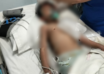 Tragis, Acara IOF EXPO Jambi Makan Korban Sebanyak 13 Orang Terluka