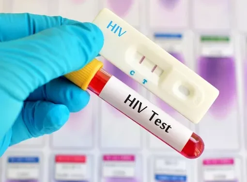Kasus HIV di Kota Jambi Meningkat Tajam Per September 2024