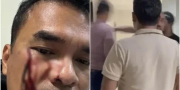 Waketum PSI Bro Ron Dipolisikan Balik soal Pemukulan